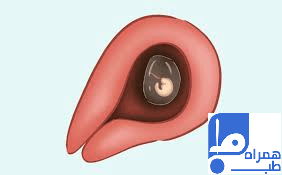 هفته چهارم بارداری